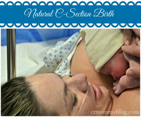 Natural C-Section Birth